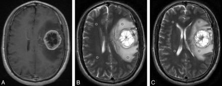 Fig 3.