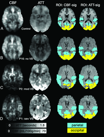 Fig 1.