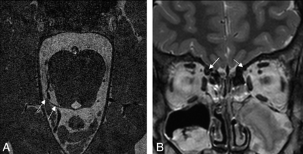 Fig 1.
