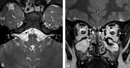 Fig 2.