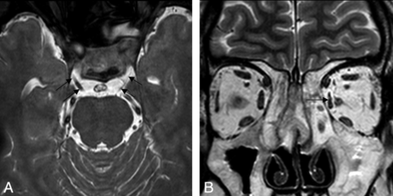 Fig 3.