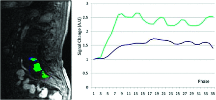 Fig 3.