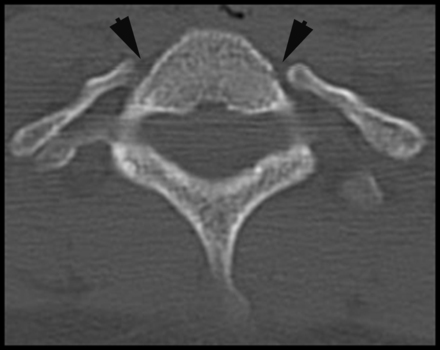 Fig 1.