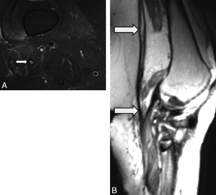 Fig 5.