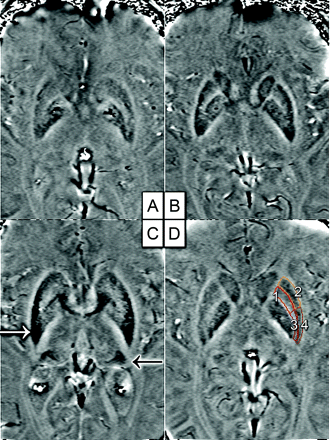 Fig 2.