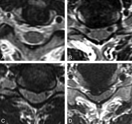 Fig 2.