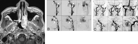 Fig 1.