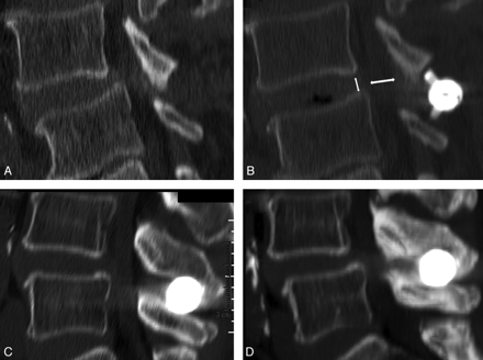 Fig 1.