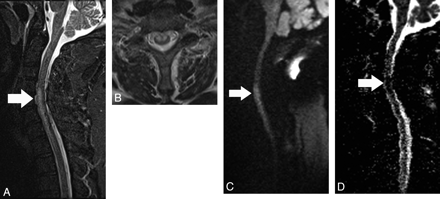 Fig 1.