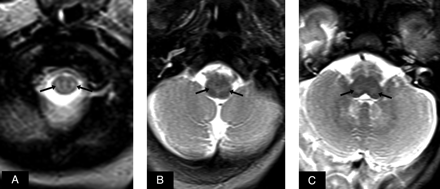 Fig 2.