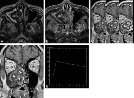 Fig 4.