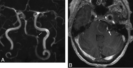 Fig 3.