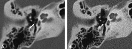 Fig 2.