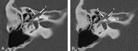 Fig 3.