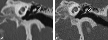 Fig 4.