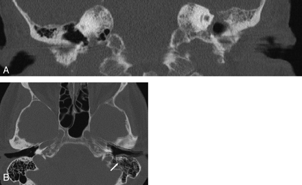 Fig 6.