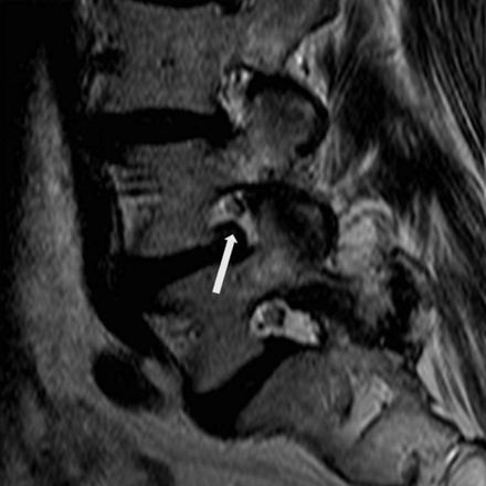 Fig 3.