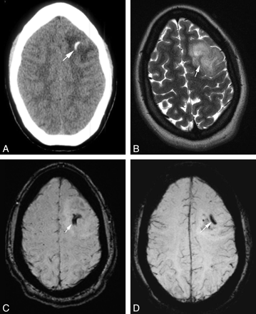 Fig 1.
