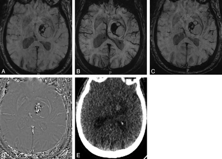 Fig 2.