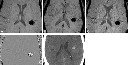 Fig 3.