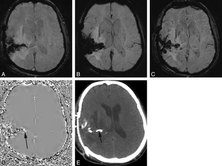 Fig 4.