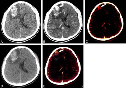 Fig 2.
