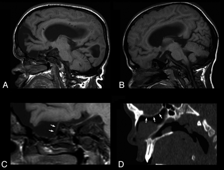 Fig 2.
