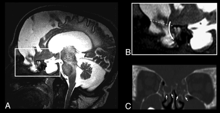 Fig 3.