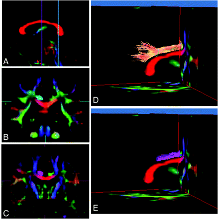 Fig 2.