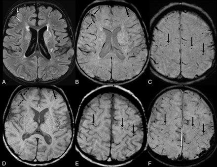 Fig 6.