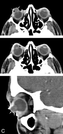 Fig 1.