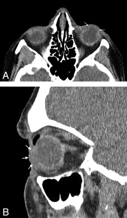 Fig 2.