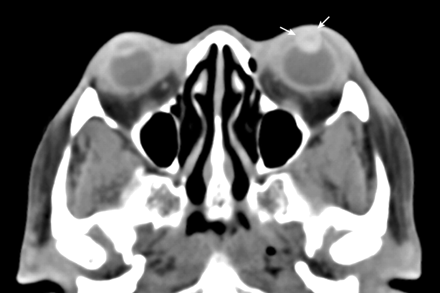 Fig 3.