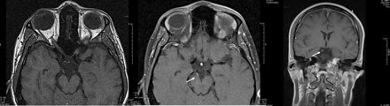 Fig 1.