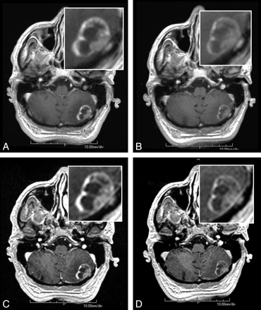 Fig 2.