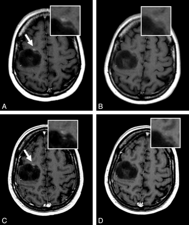 Fig 3.