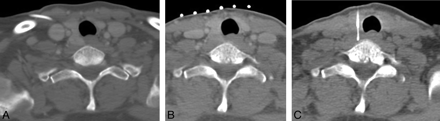 Fig 5.
