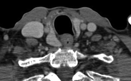 Fig 8.