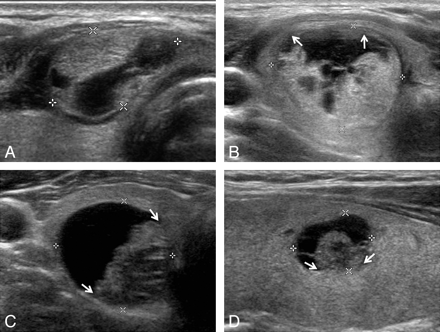Fig 3.