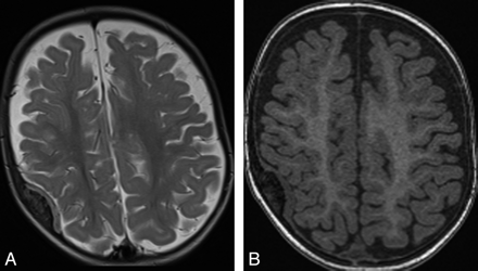 Fig 1.