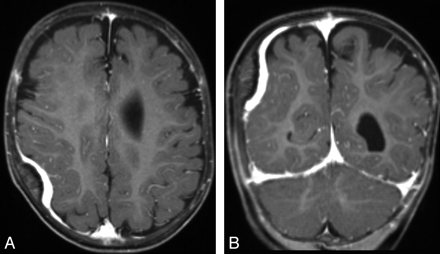 Fig 2.