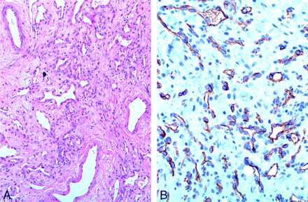 Fig 4.