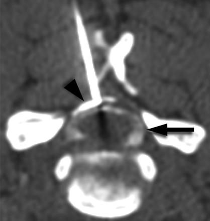 Fig 2.