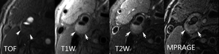 Fig 3.