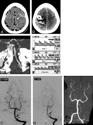 Fig 6.