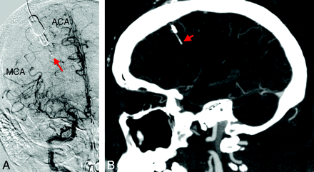 Fig 1.