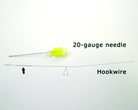 Fig 1.