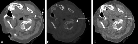 Fig 2.