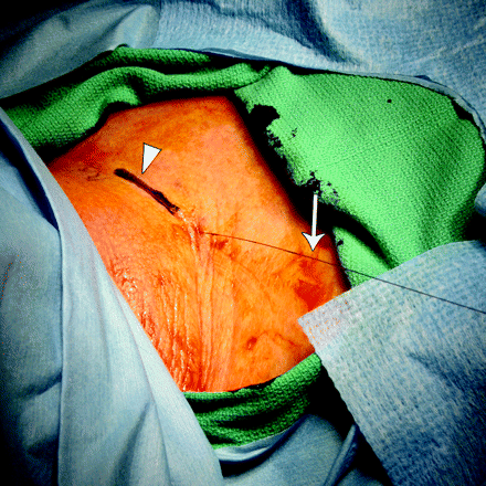 Fig 3.