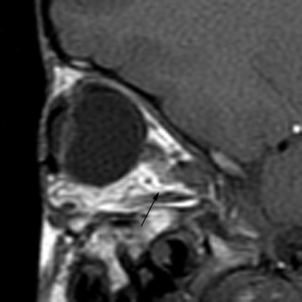 Fig 10.